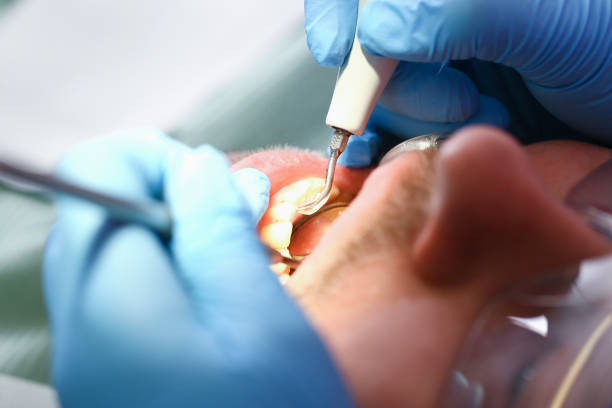 Reliable WV Emergency Dentist Solutions