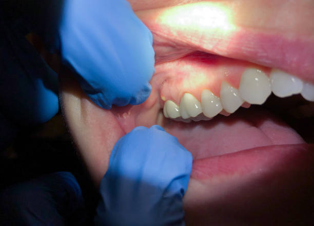 Best Emergency Dental Services Near Me  in Coal Fork, WV